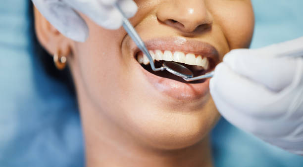 Best Emergency Denture Repair in White Rock, NM